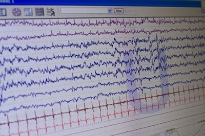 Data gathered during a sleep study