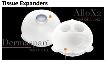 Tissue expanders used in breast reconstruction